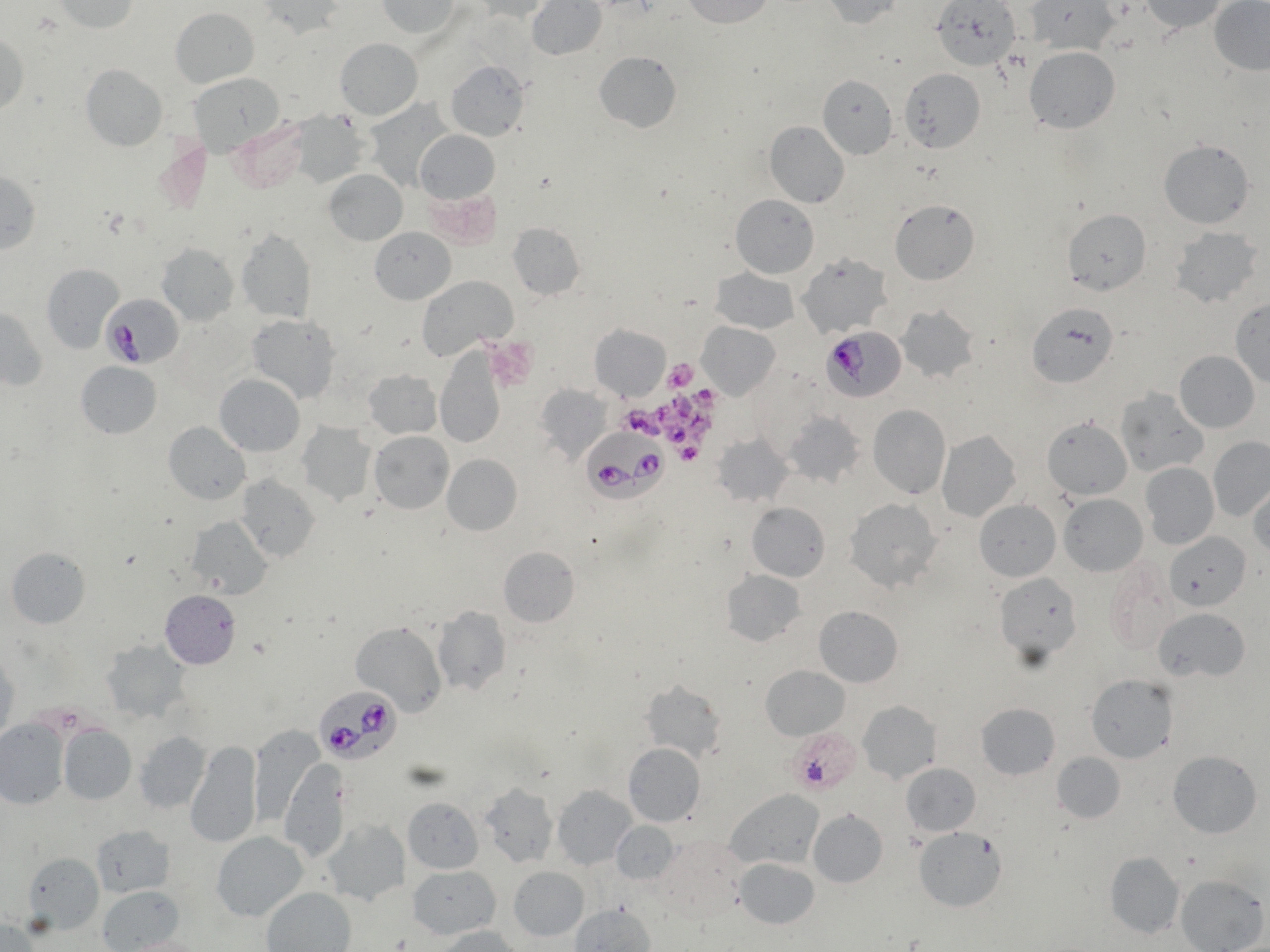 Babesiose hos hund en ny diagnose i Danmark Dansk Veterinærtidsskrift