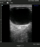 Ovarian Cyst Ultrasound approach, part 1 Dansk Veterinærtidsskrift